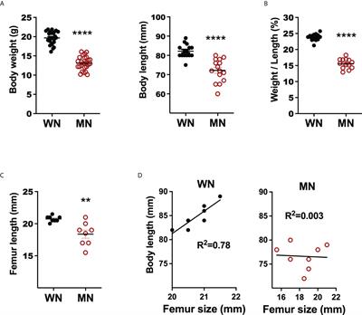 Inflammatory stimuli alter bone marrow composition and compromise bone health in the malnourished host